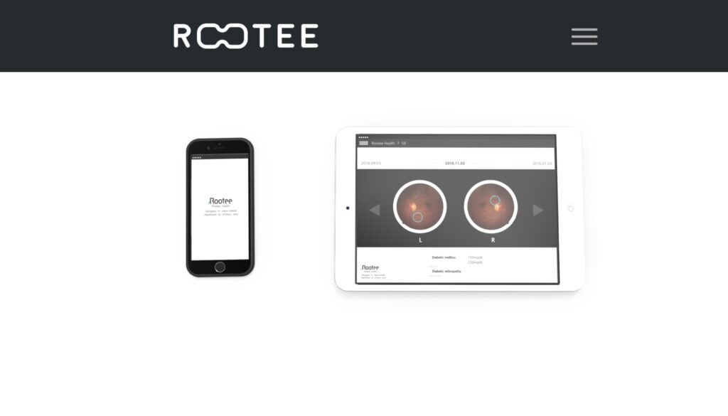 image2 3 Rootee Health protects your eyes with disease test solution