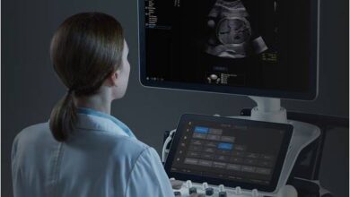 Intel AI Powers Samsung Medison’s Fetal Ultrasound Smart Workflow