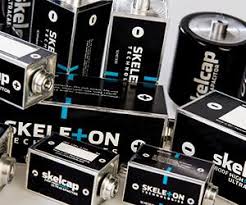 Skeleton Technologies: the battery of the future?