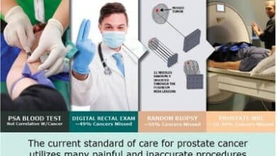 Revolutionary Prostate Cancer Screening with ProstatID AI