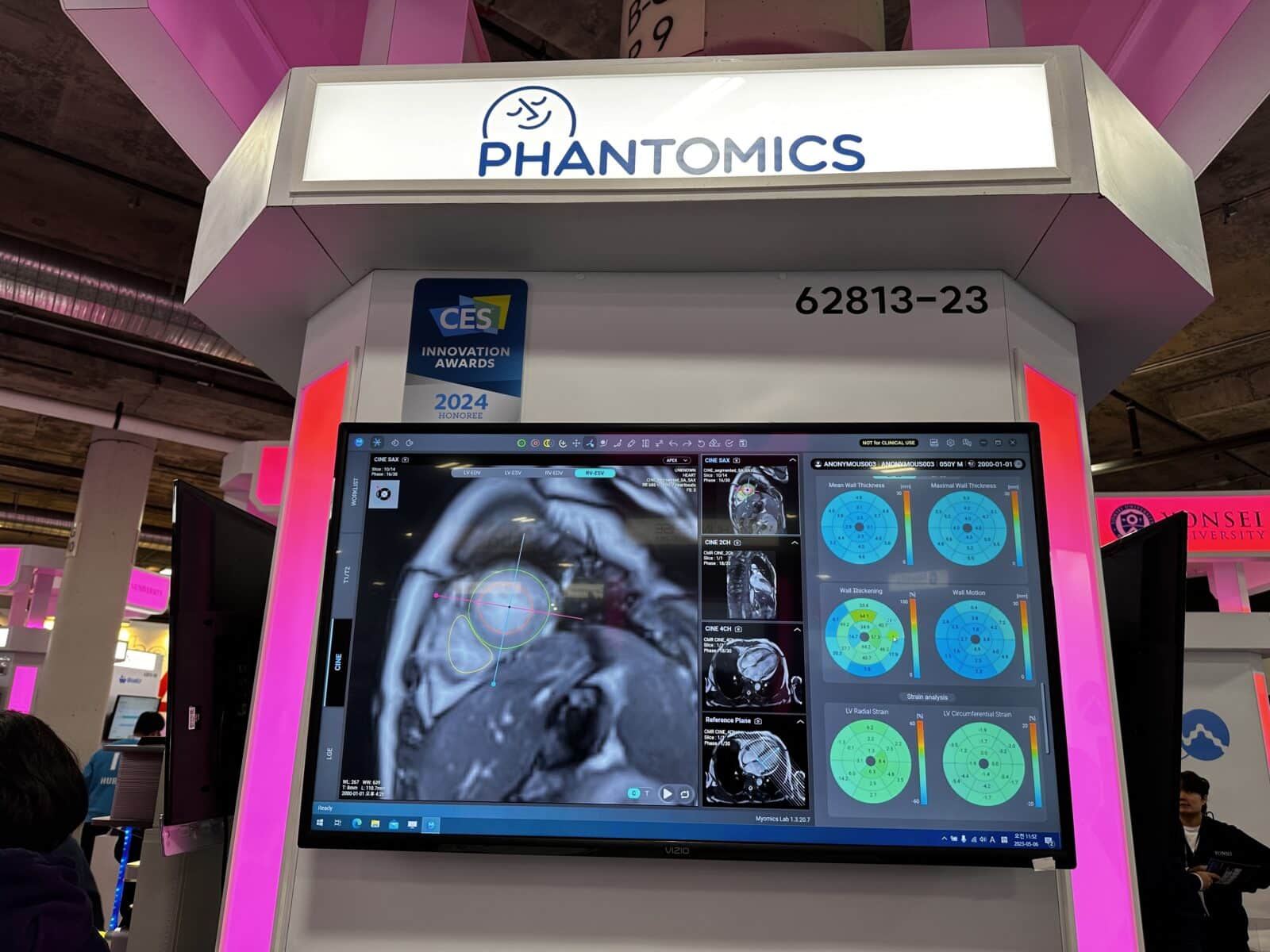 Phantomics interview CES 2024